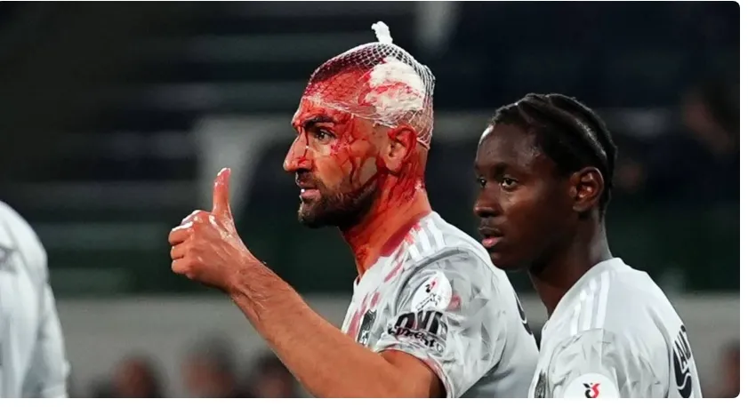 Serdar Dursun ve Jerome Opoku hava topu mücadelesinde çarpıştı