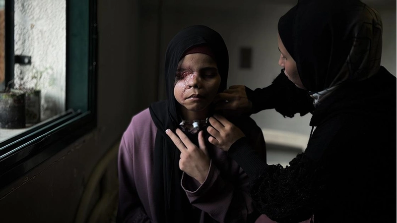 İsrail saldırısı nedeniyle yüzü tanınmaz hale gelen 15 yaşındaki Gazzeli Neda