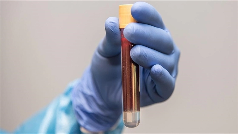 Kardeşinde prostat kanseri öyküsü olanlara 45 yaşından itibaren tarama önerisi