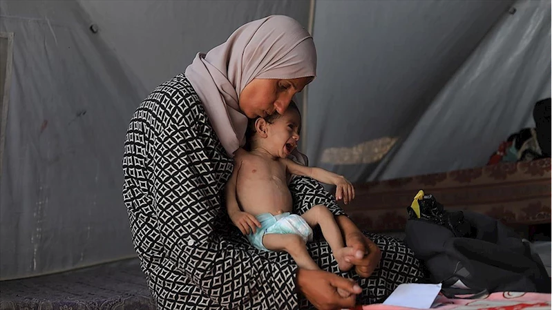 UNICEF: Haziran ayında Gazze’de 5800 çocuğa yetersiz beslenme teşhisi konuldu