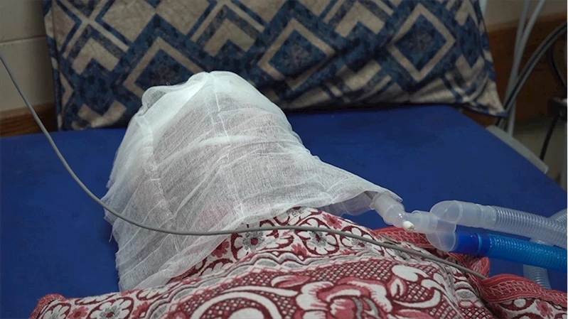 Gazzeli baba, çocuklarına yiyecek bulmaya gitti, beynine yediği kurşunla komaya girdi
